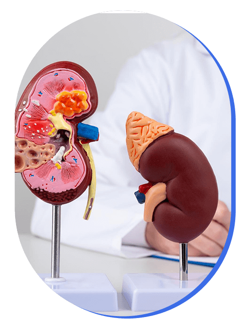 consulta-de-salud-renal.png