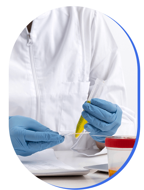 estudio-de-microalbuminuria.png