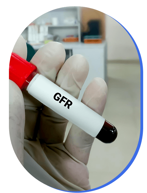 estudio-de-velocidad-de-filtracion-glomerular.png