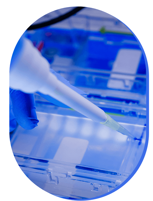 estudios-de-electroforesis-urinaria.png
