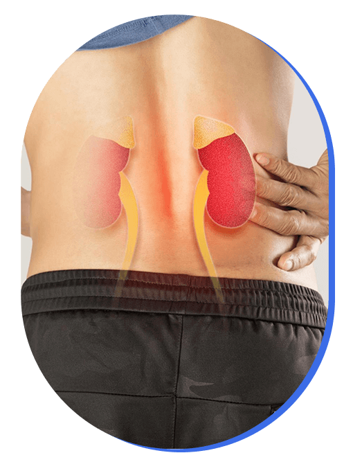 manejo-de-insuficiencia-renal.png